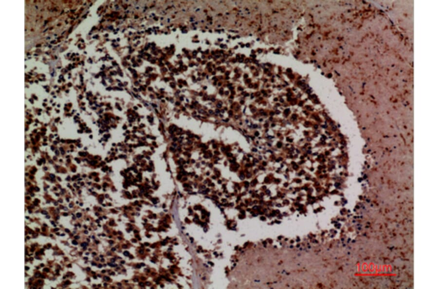 Immunohistochemistry - Anti-ICAM3 Antibody (C30362) - Antibodies.com