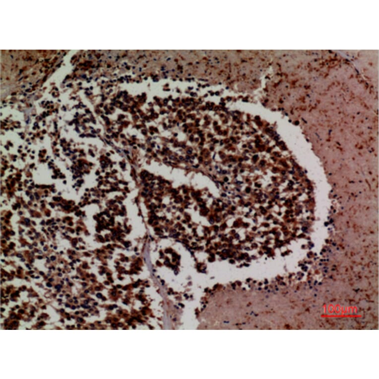 Immunohistochemistry - Anti-ICAM3 Antibody (C30362) - Antibodies.com