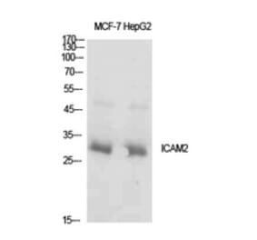 Western Blot - Anti-ICAM2 Antibody (C30407) - Antibodies.com