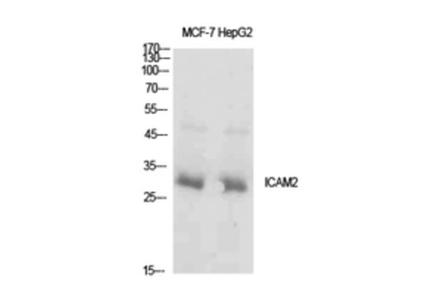 Western Blot - Anti-ICAM2 Antibody (C30407) - Antibodies.com