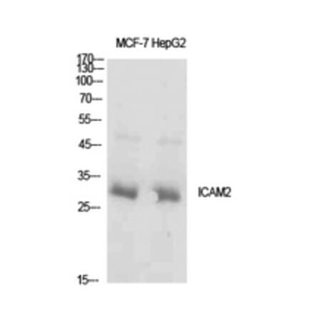 Western Blot - Anti-ICAM2 Antibody (C30407) - Antibodies.com