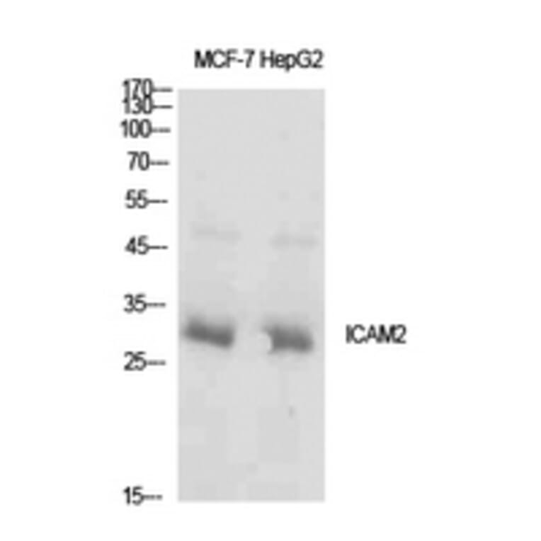 Western Blot - Anti-ICAM2 Antibody (C30407) - Antibodies.com