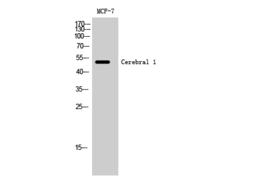 Western Blot - Anti-HUCE1 Antibody (C15060) - Antibodies.com