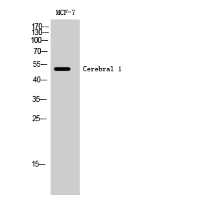 Western Blot - Anti-HUCE1 Antibody (C15060) - Antibodies.com