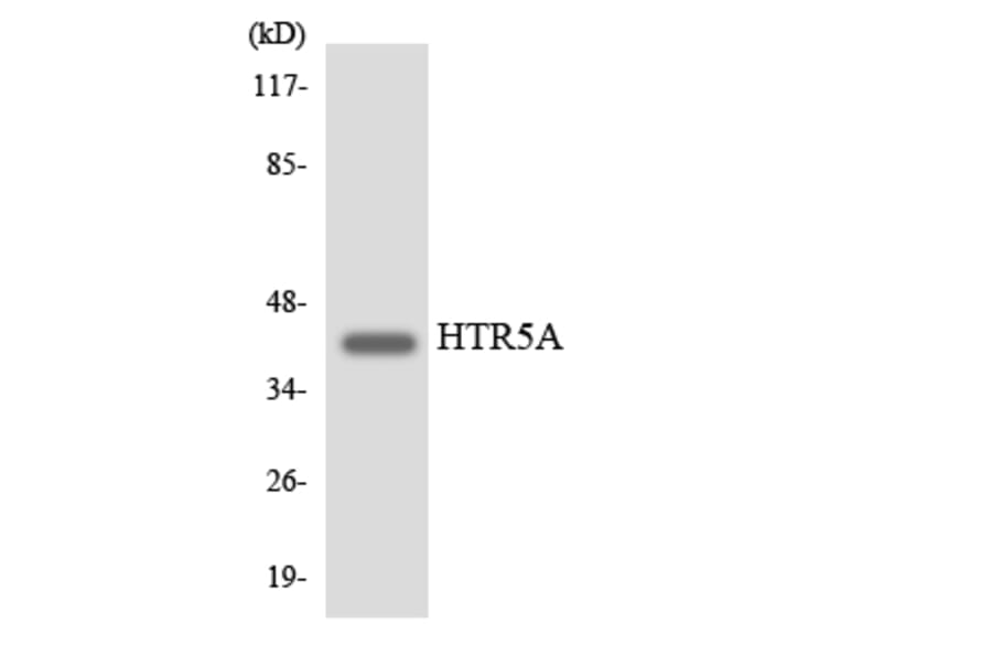 Western Blot - Anti-HTR5A Antibody (R12-2904) - Antibodies.com