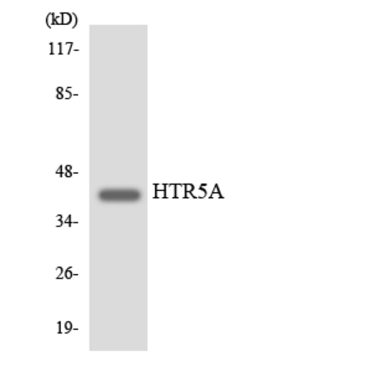 Western Blot - Anti-HTR5A Antibody (R12-2904) - Antibodies.com
