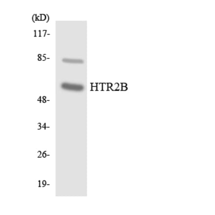 Western Blot - Anti-HTR2B Antibody (R12-2901) - Antibodies.com