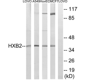 Western Blot - Anti-HOXB2 Antibody (C16300) - Antibodies.com