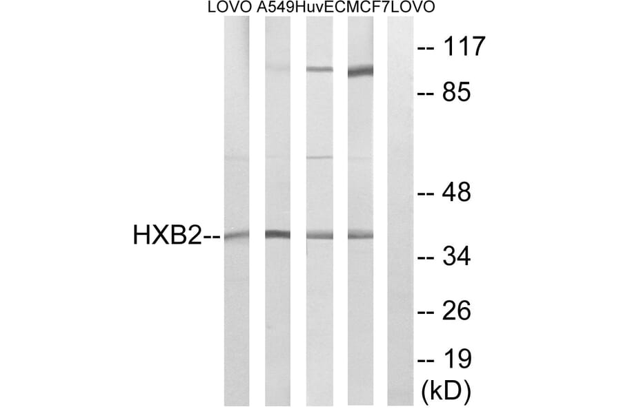 Western Blot - Anti-HOXB2 Antibody (C16300) - Antibodies.com