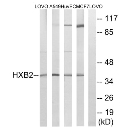 Western Blot - Anti-HOXB2 Antibody (C16300) - Antibodies.com