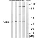 Western Blot - Anti-HOXB2 Antibody (C16300) - Antibodies.com