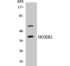 Western Blot - Anti-HOXB2 Antibody (R12-2890) - Antibodies.com