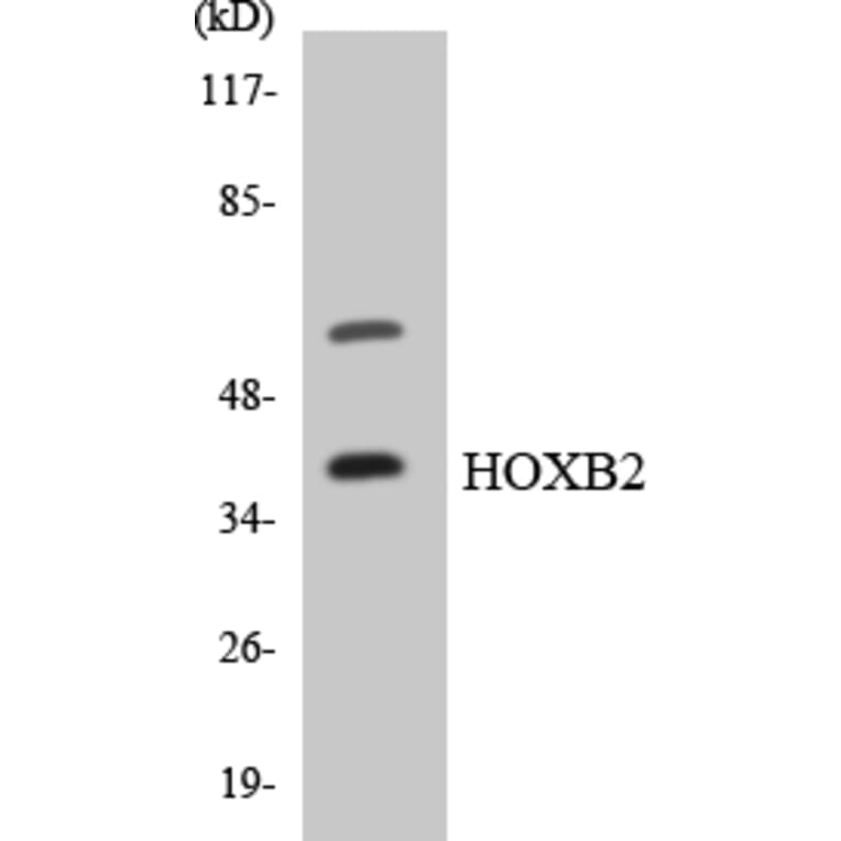 Western Blot - Anti-HOXB2 Antibody (R12-2890) - Antibodies.com