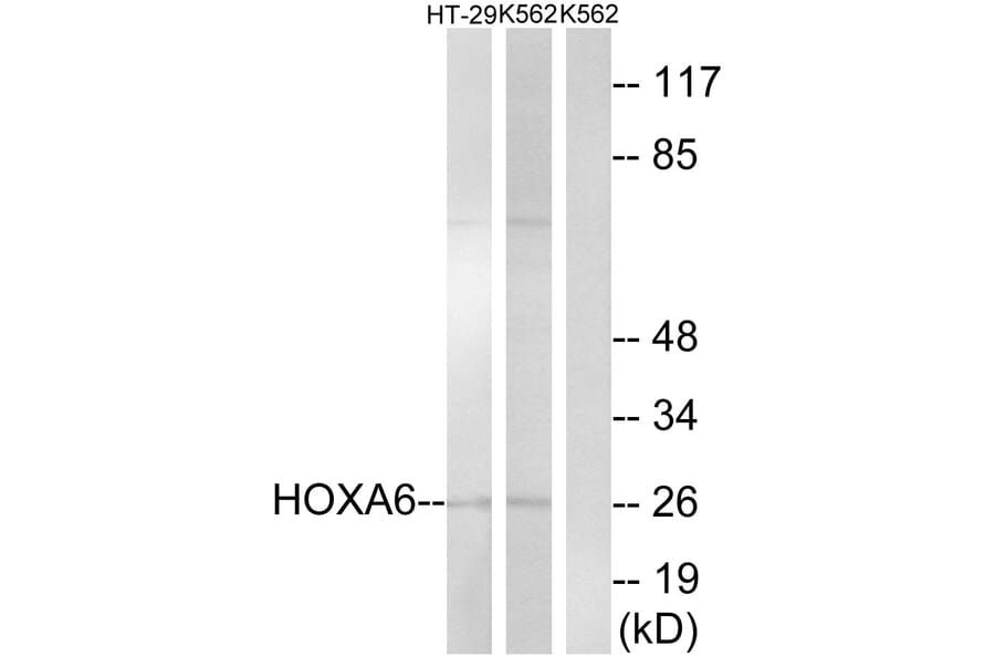 Western Blot - Anti-HOXA6 Antibody (C16295) - Antibodies.com