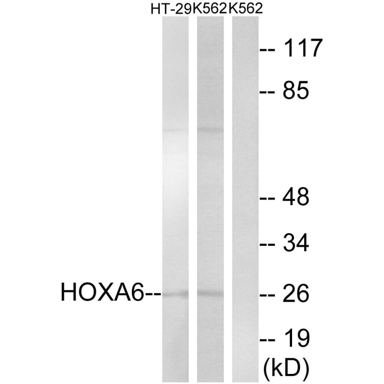 Western Blot - Anti-HOXA6 Antibody (C16295) - Antibodies.com