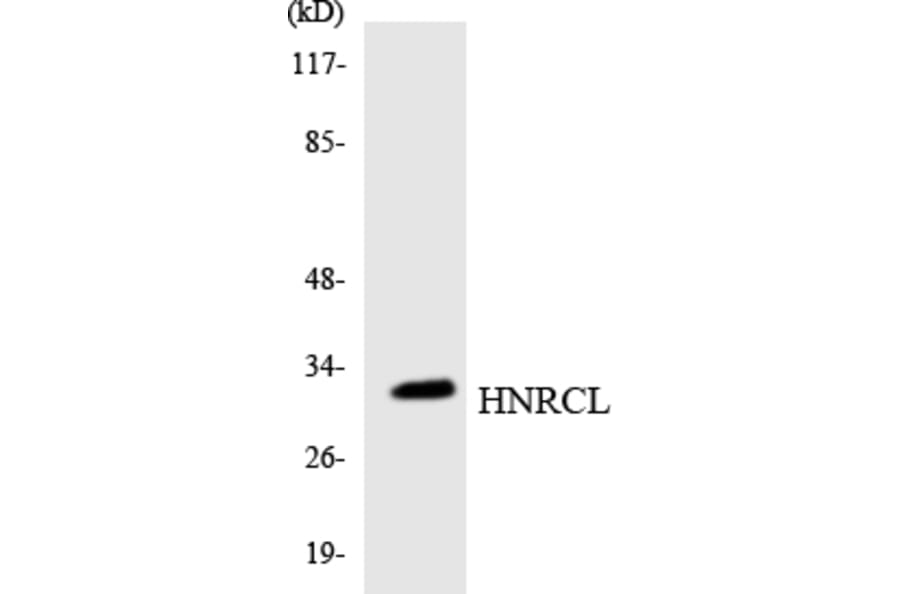 Western Blot - Anti-HNRCL Antibody (R12-2885) - Antibodies.com