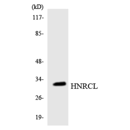 Western Blot - Anti-HNRCL Antibody (R12-2885) - Antibodies.com