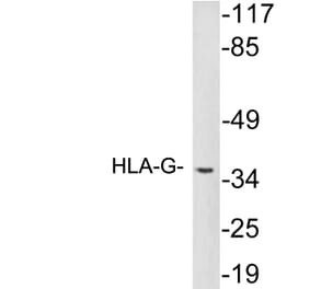 Western Blot - Anti-HLA-G Antibody (R12-2183) - Antibodies.com