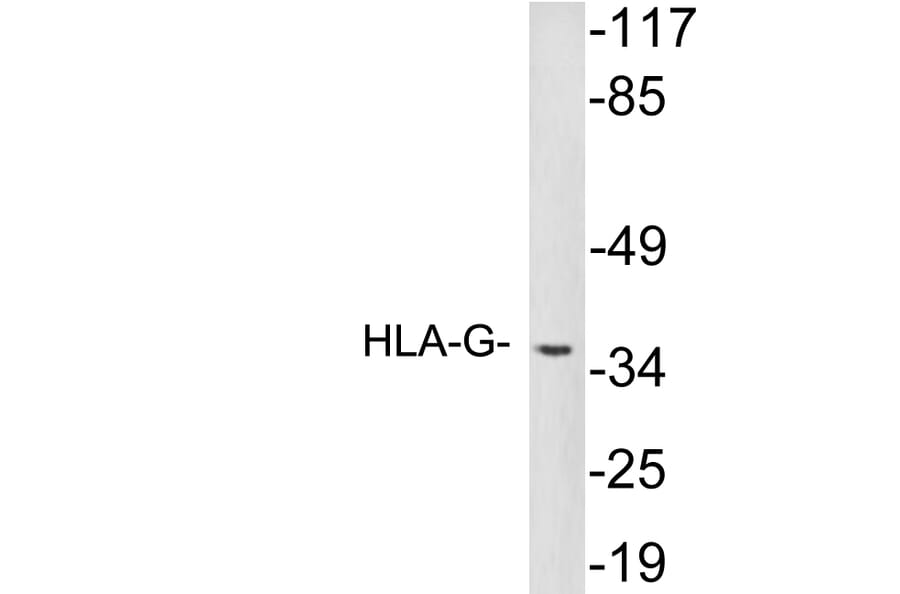 Western Blot - Anti-HLA-G Antibody (R12-2183) - Antibodies.com