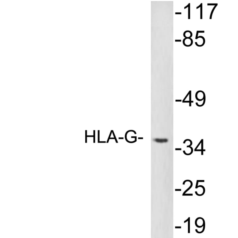 Western Blot - Anti-HLA-G Antibody (R12-2183) - Antibodies.com
