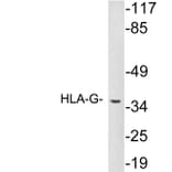 Western Blot - Anti-HLA-G Antibody (R12-2183) - Antibodies.com