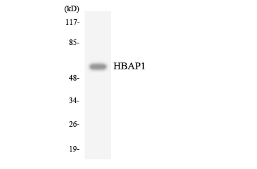 Western Blot - Anti-HBAP1 Antibody (R12-2865) - Antibodies.com