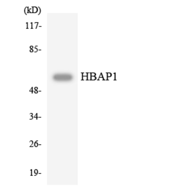 Western Blot - Anti-HBAP1 Antibody (R12-2865) - Antibodies.com