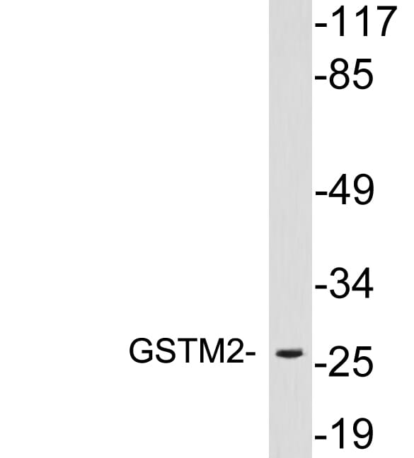 Western blot analysis of lysates from 293 cells using Anti-GSTM2 Antibody.