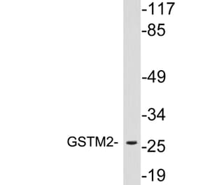 Western Blot - Anti-GSTM2 Antibody (R12-2175) - Antibodies.com