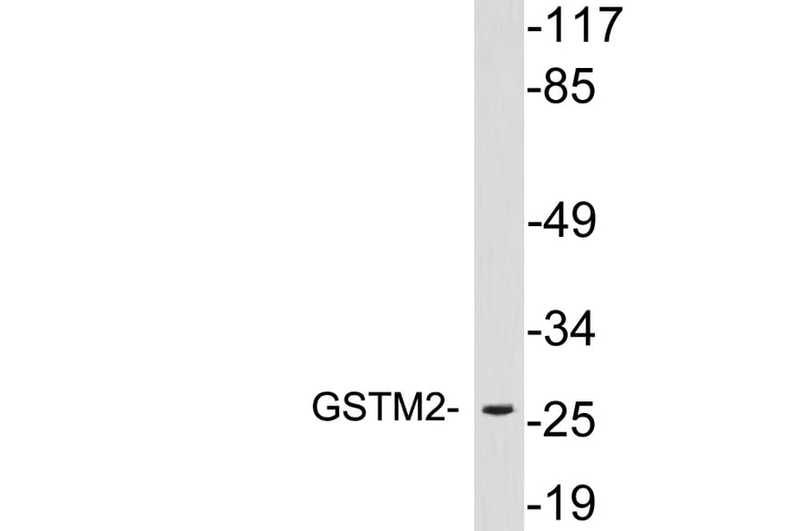 Western Blot - Anti-GSTM2 Antibody (R12-2175) - Antibodies.com