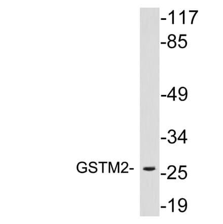 Western Blot - Anti-GSTM2 Antibody (R12-2175) - Antibodies.com