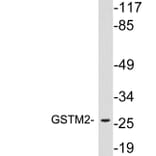 Western Blot - Anti-GSTM2 Antibody (R12-2175) - Antibodies.com
