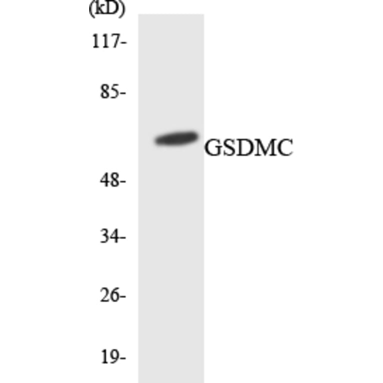 Western Blot - Anti-GSDMC Antibody (R12-2862) - Antibodies.com