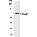 Western Blot - Anti-GSDMC Antibody (R12-2862) - Antibodies.com