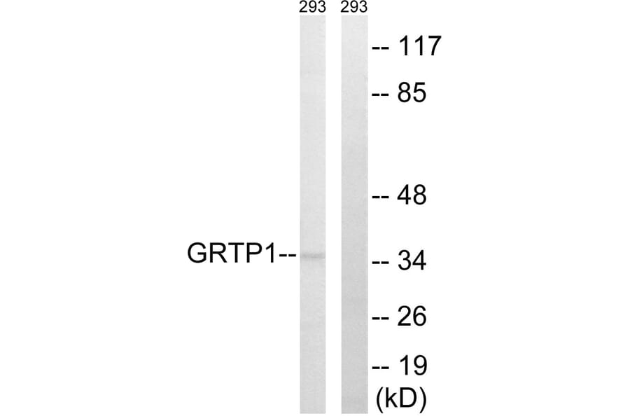 Western Blot - Anti-GRTP1 Antibody (C15978) - Antibodies.com