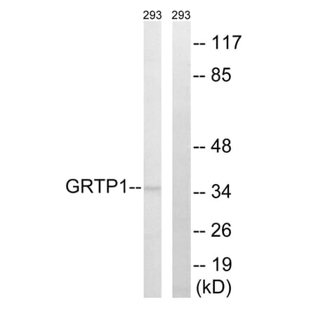 Western Blot - Anti-GRTP1 Antibody (C15978) - Antibodies.com