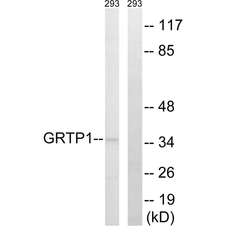 Western Blot - Anti-GRTP1 Antibody (C15978) - Antibodies.com