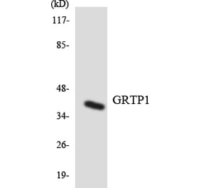 Western Blot - Anti-GRTP1 Antibody (R12-2861) - Antibodies.com