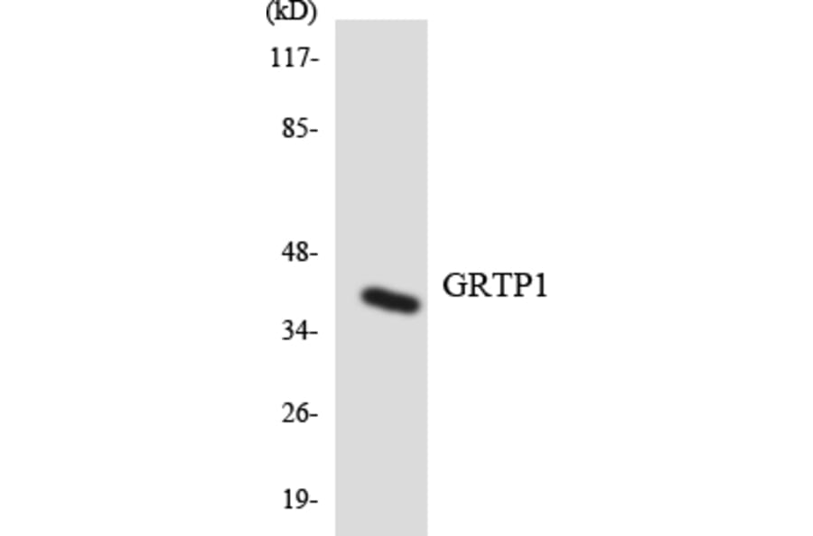 Western Blot - Anti-GRTP1 Antibody (R12-2861) - Antibodies.com