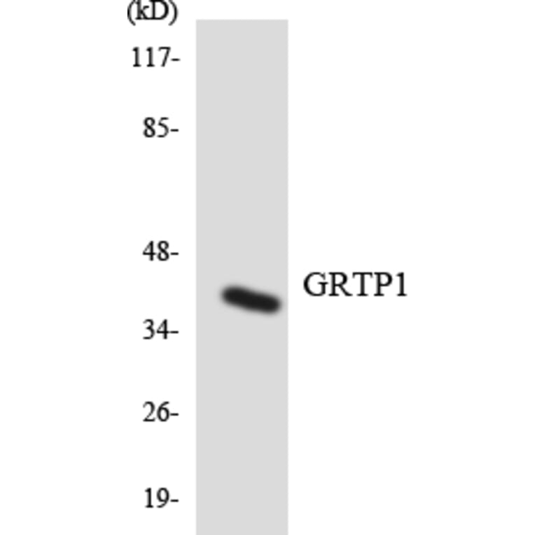 Western Blot - Anti-GRTP1 Antibody (R12-2861) - Antibodies.com