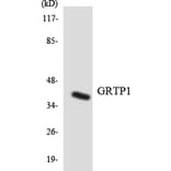 Western Blot - Anti-GRTP1 Antibody (R12-2861) - Antibodies.com