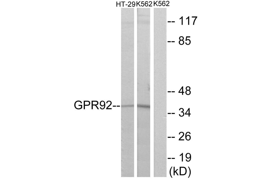 Western Blot - Anti-GPR92 Antibody (G360) - Antibodies.com