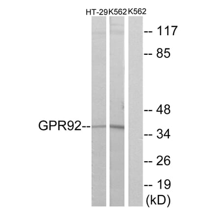 Western Blot - Anti-GPR92 Antibody (G360) - Antibodies.com