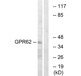 Western Blot - Anti-GPR62 Antibody (G348) - Antibodies.com