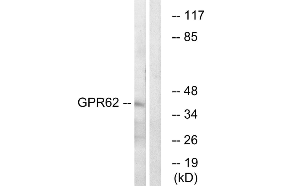 Western Blot - Anti-GPR62 Antibody (G348) - Antibodies.com