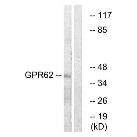 Western Blot - Anti-GPR62 Antibody (G348) - Antibodies.com