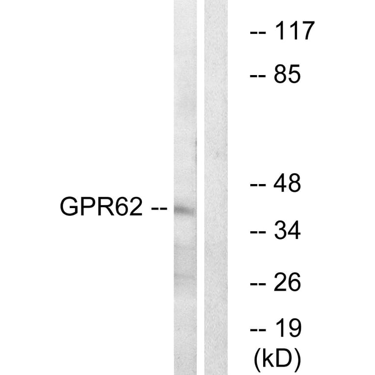 Western Blot - Anti-GPR62 Antibody (G348) - Antibodies.com