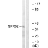 Western Blot - Anti-GPR62 Antibody (G348) - Antibodies.com