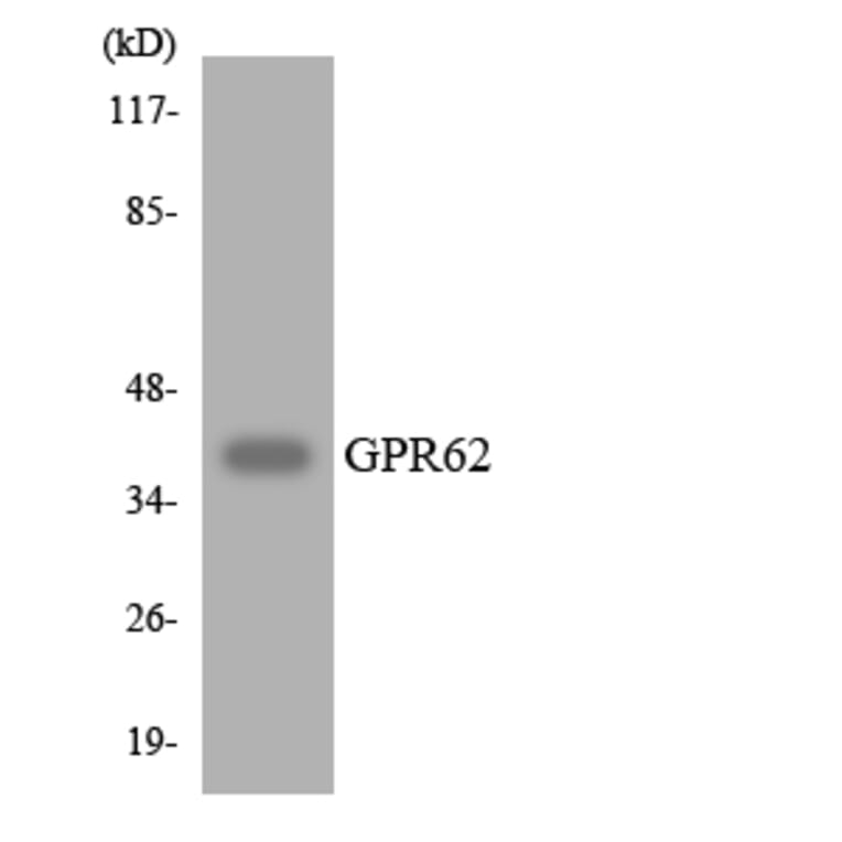 Western Blot - Anti-GPR62 Antibody (R12-2847) - Antibodies.com