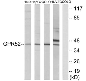 Western Blot - Anti-GPR52 Antibody (G344) - Antibodies.com